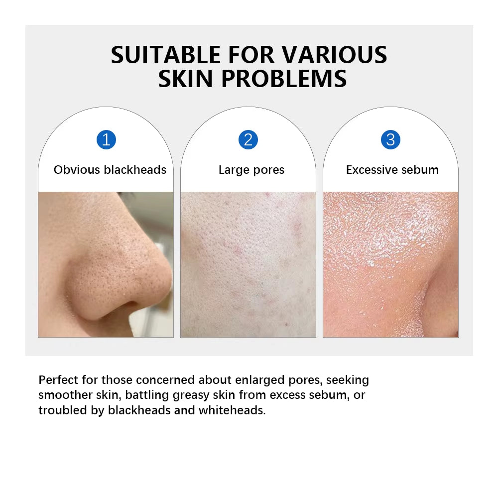 Zero Pore Pad 2.0 Double Textured Facial Toner for Exfoliating and Smoothing Pores Korean Skin Care Pad for All Skin Types 70Pcs